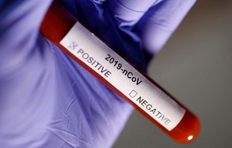 FILE PHOTO: Test tube with Coronavirus label is seen in this illustration