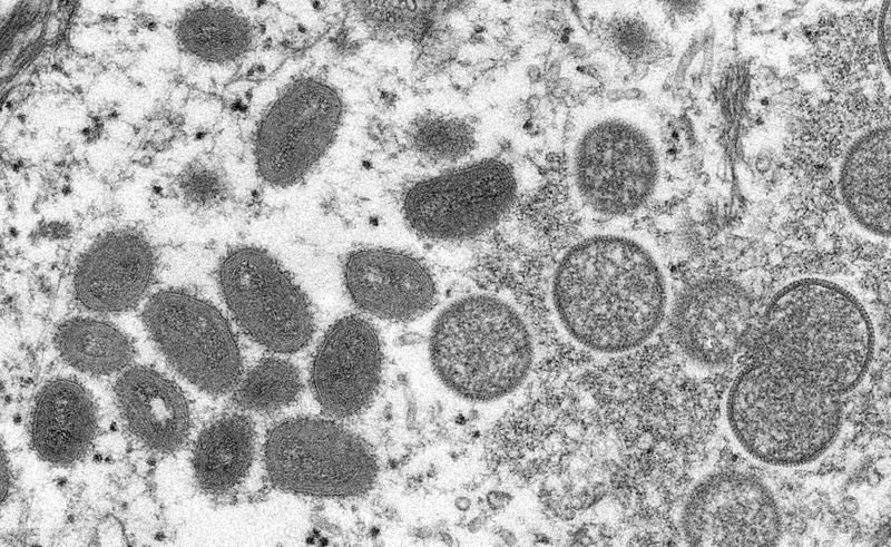 ARCHIV: Ein mikroskopisches Bild von Partikeln des Affenpockenvirus, 18. Mai 2022. Cynthia S. Goldsmith, Russell Regnery/CDC/Handout via REUTERS